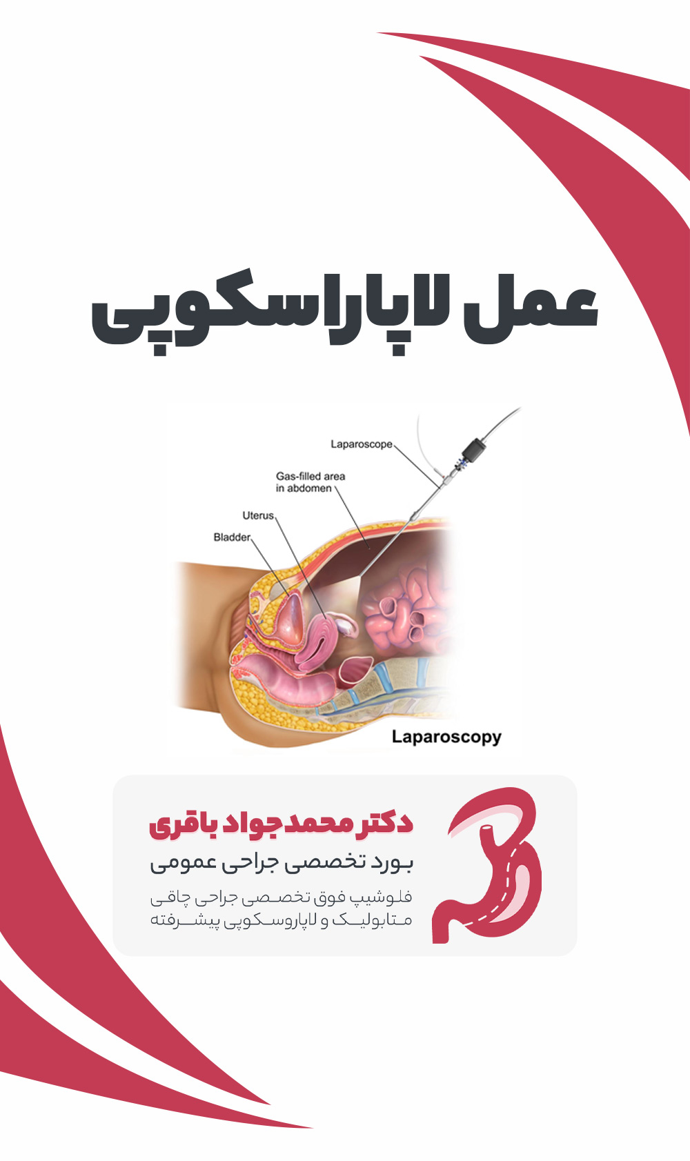 Laparoscopic surgery phone