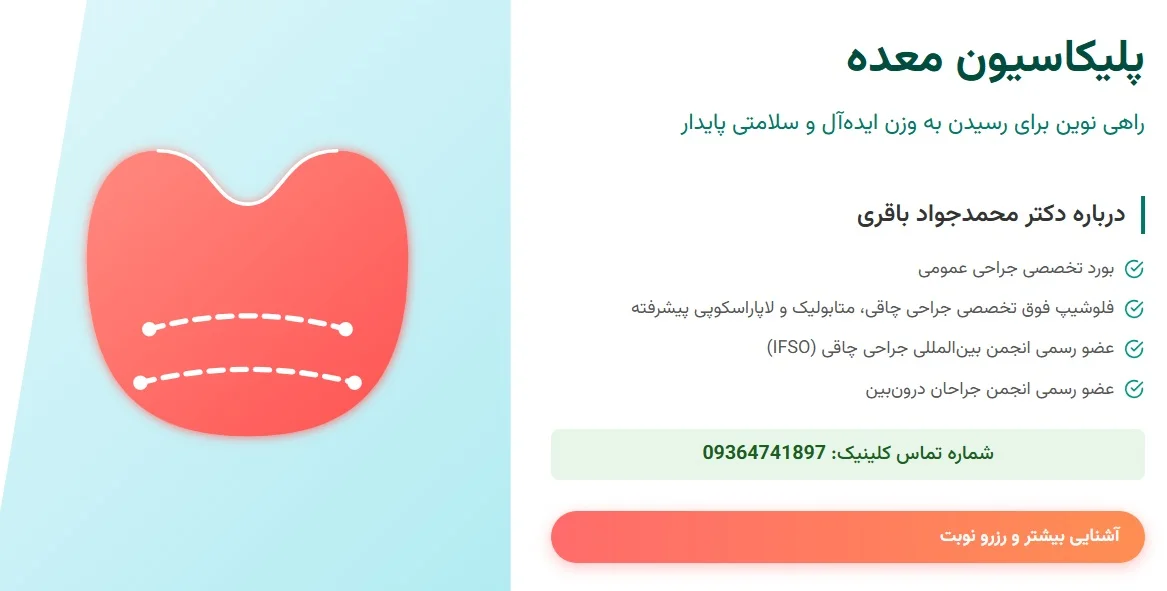مشاوره برای پلیکاسیون معده