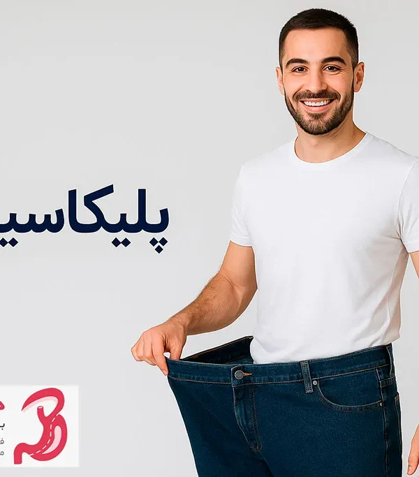 جراحی پلیکاسیون معده