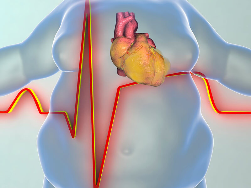 چاقی و بیماری قلبی