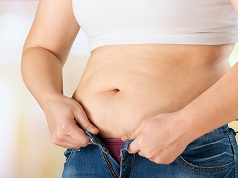 جلوگیری از چاقی شکم بعد از ابدومینوپلاستی