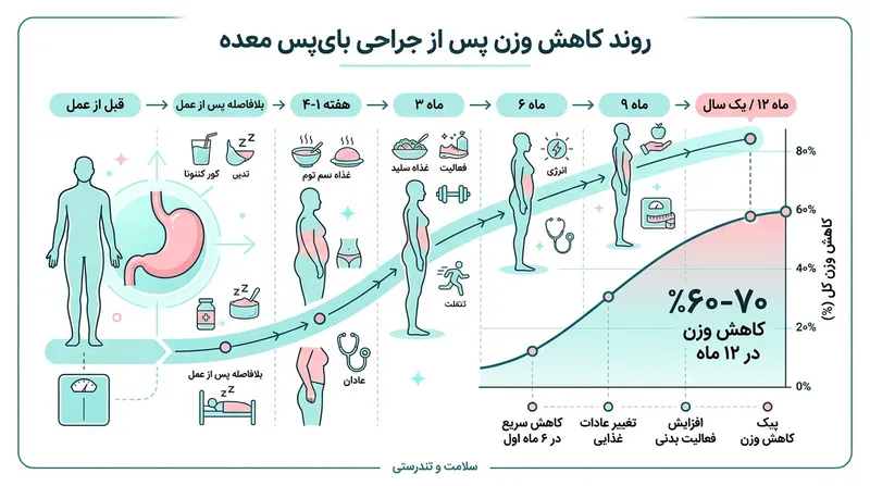 اینفوگرافیک میزان کاهش وزن بعد از عمل بای پس معده در ۱۲ ماه