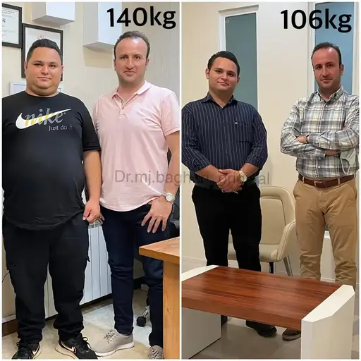 قبل و بعد از عمل اسلیو معده 1 1