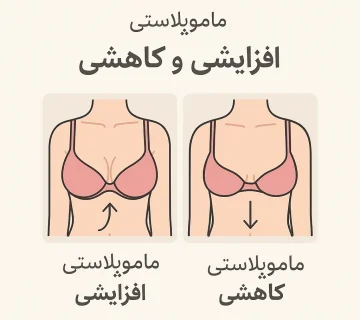 تفاوت ماموپلاستی افزایشی و کاهشی