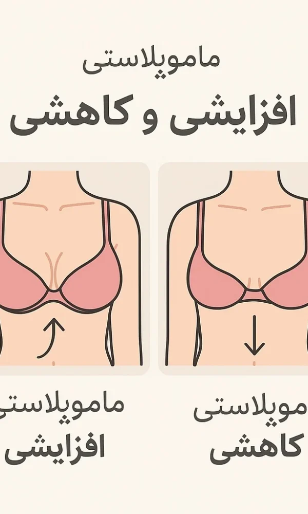 تفاوت ماموپلاستی افزایشی و کاهشی