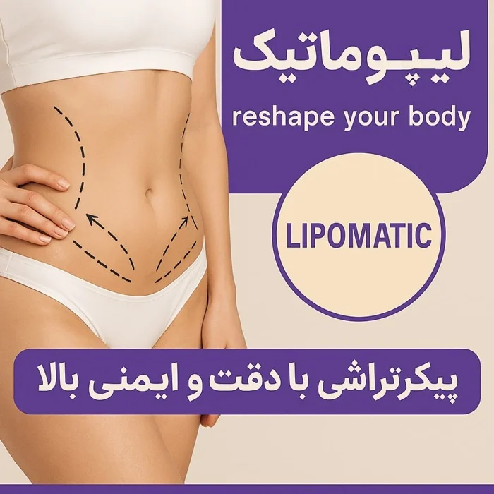 لیپوماتیک