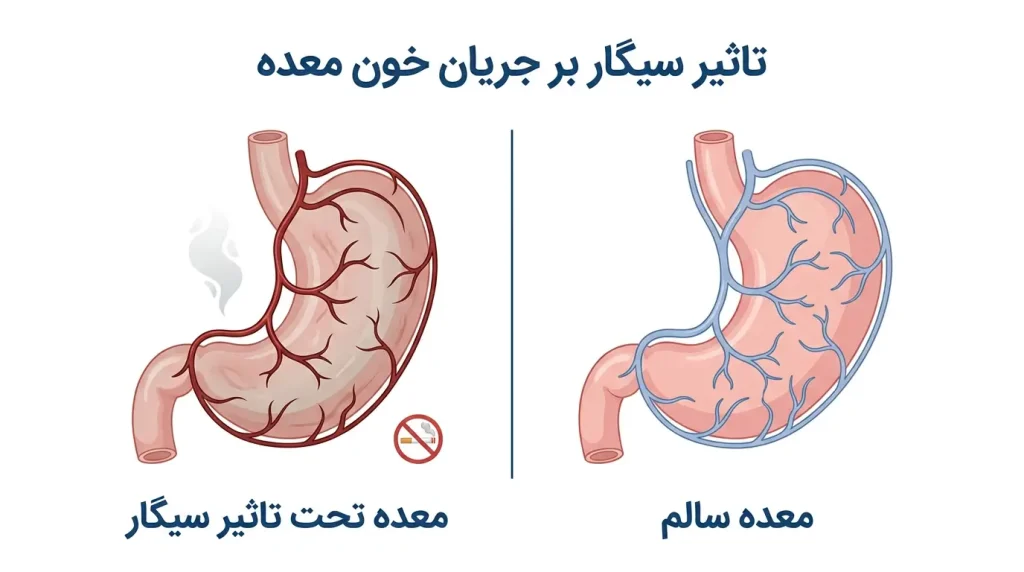 عوارض سیگار بعد از بوتاکس معده بر سلامت معده