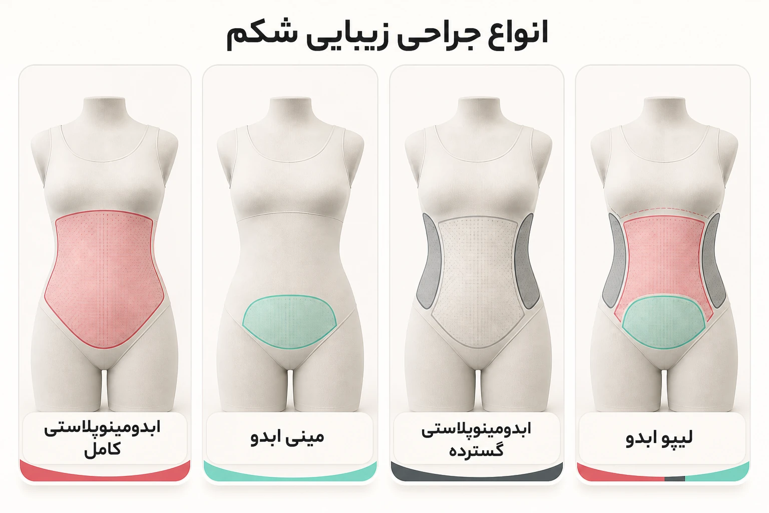 انواع جراحی زیبایی شکم؛ ابدومینوپلاستی کامل، مینی ابدو، گسترده و لیپو ابدو